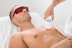laser hair removal
